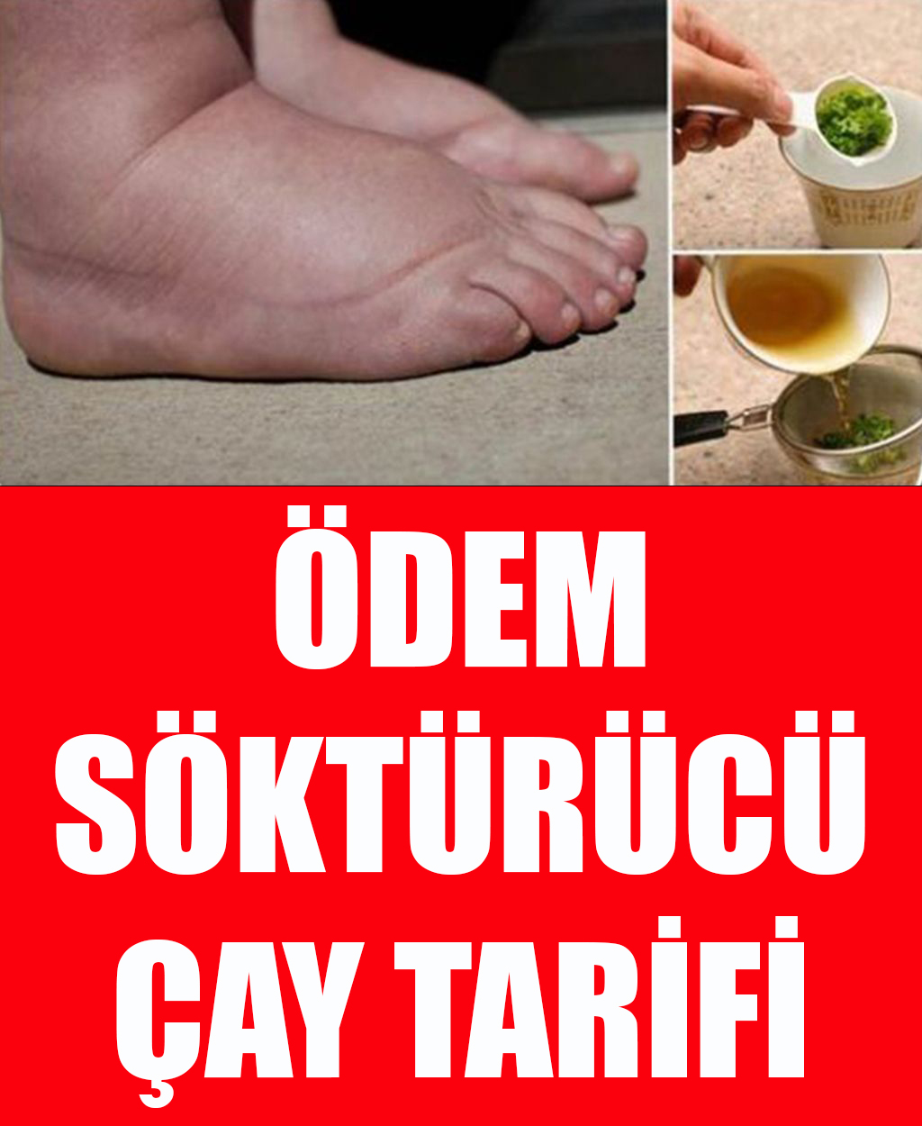 Ödem Söktürücü Bitki Çayı Tarifi - 1