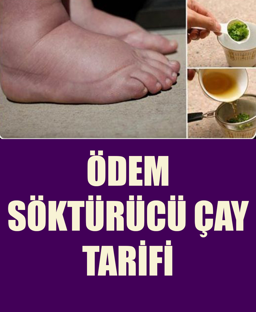 Ödem Söktürücü Çay Tarifi	 - 1