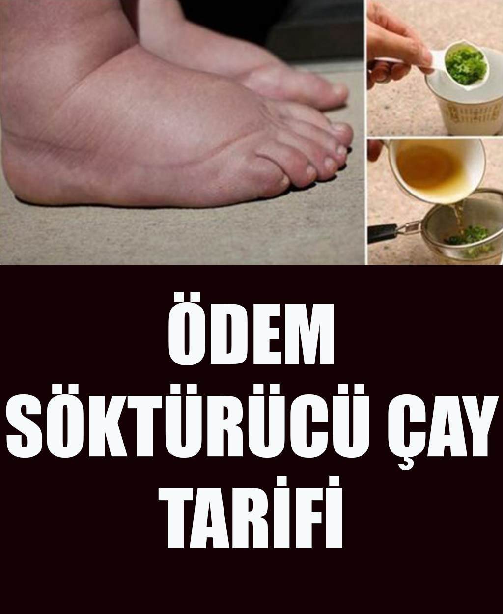 Ödem Söktürücü Çay Tarifi - 1