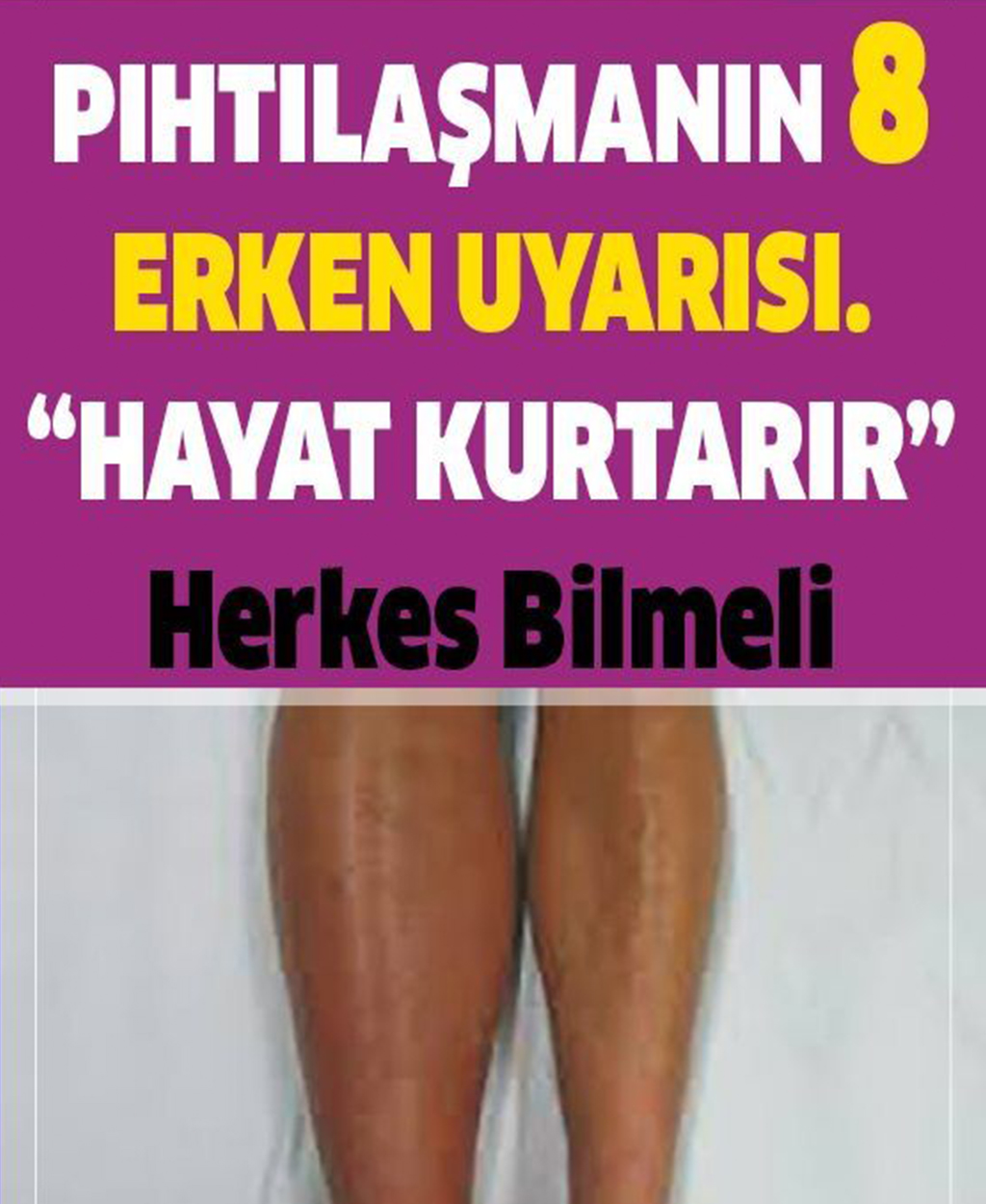 Pıhtılaşmanın 8 Erken Belirtisi	 - 1