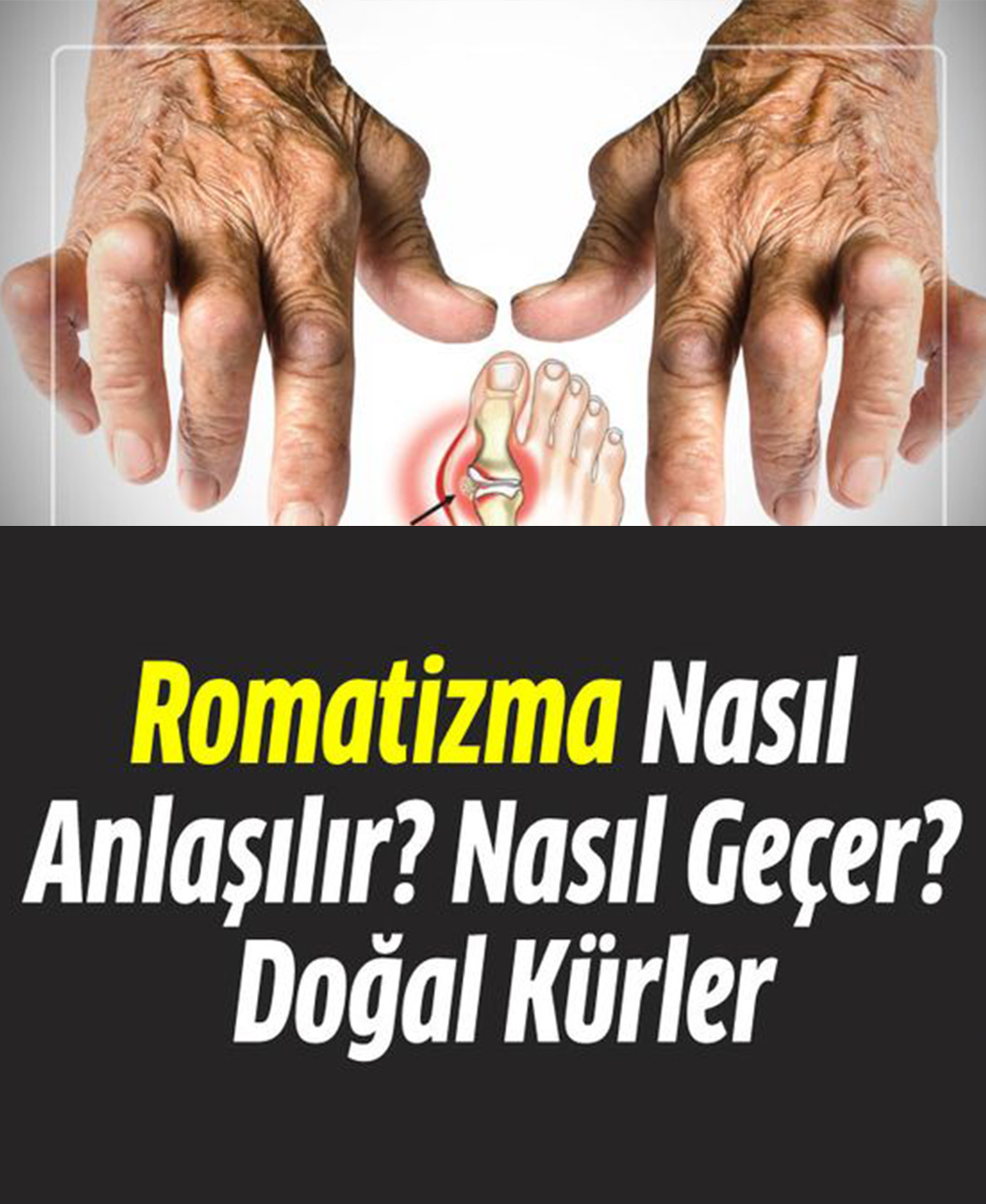 Romatizma belirtileri nelerdir? Romatizmayı geçirecek doğal formül - 1