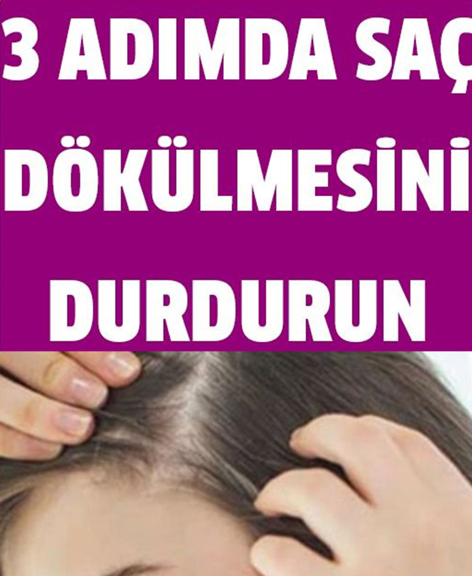 3 Adımda Saç Dökülmesini Durdurun - 1