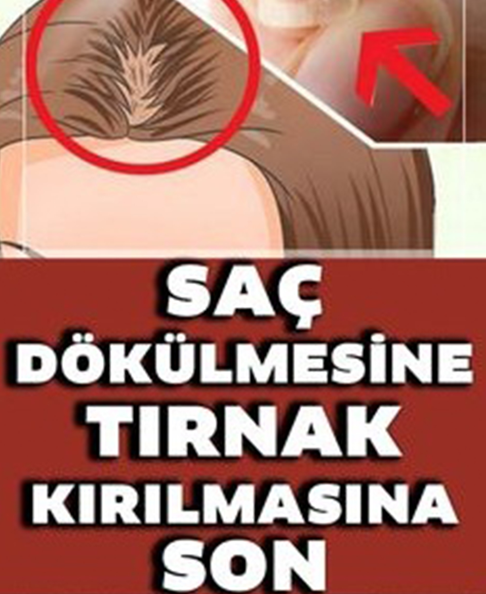 Saç Dökülmesine, Tırnak Kırılmasına ve Uykusuzluğa Ne İyi Gelir - 1