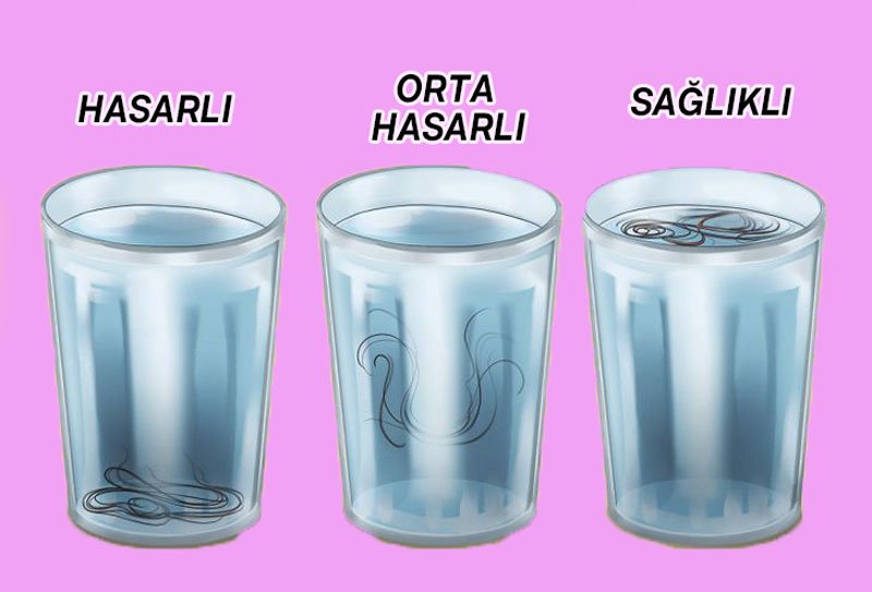 Saçın Ne Durumda Olduğunu Gösteren Saç Testi - 2