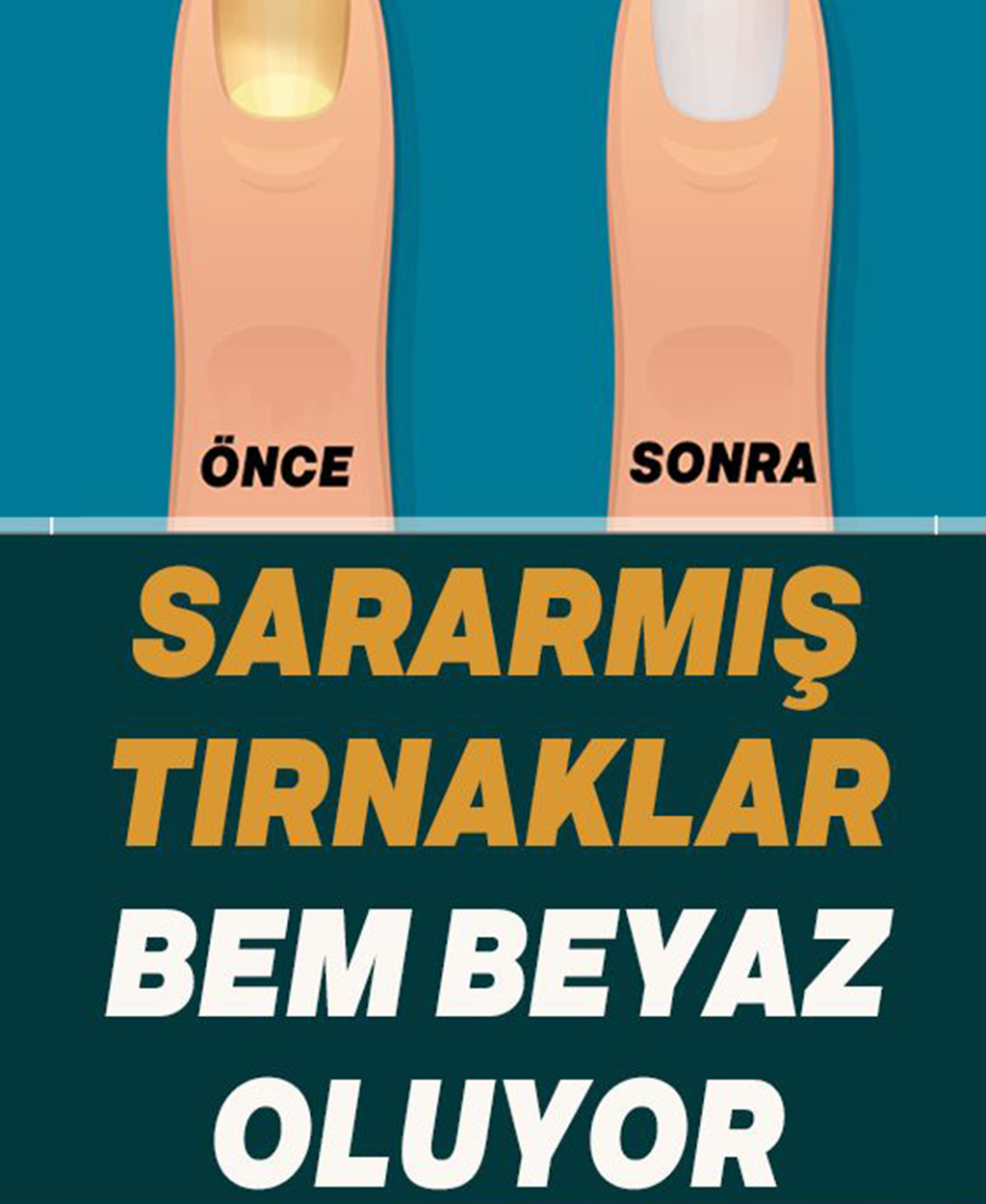 Sararan Tırnaklara Ne İyi Gelir - 1
