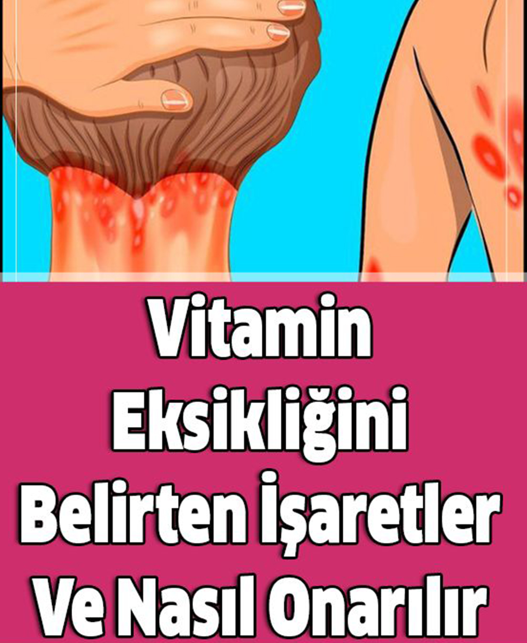Vitamin Eksikliğini Belirten İşaretler Ve Nasıl Onarılır - 1