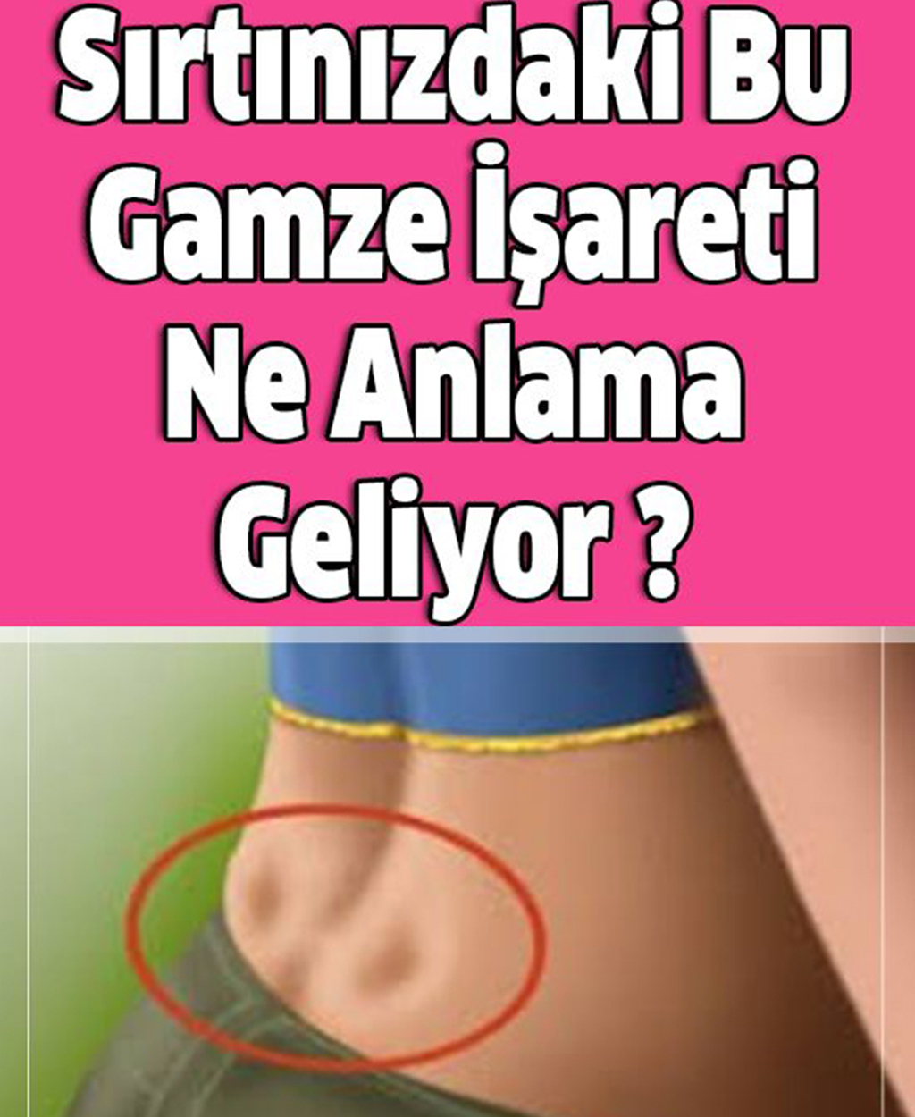 Sırtınızdaki Bu Gamze İşareti Ne Anlama Geliyor  - 1