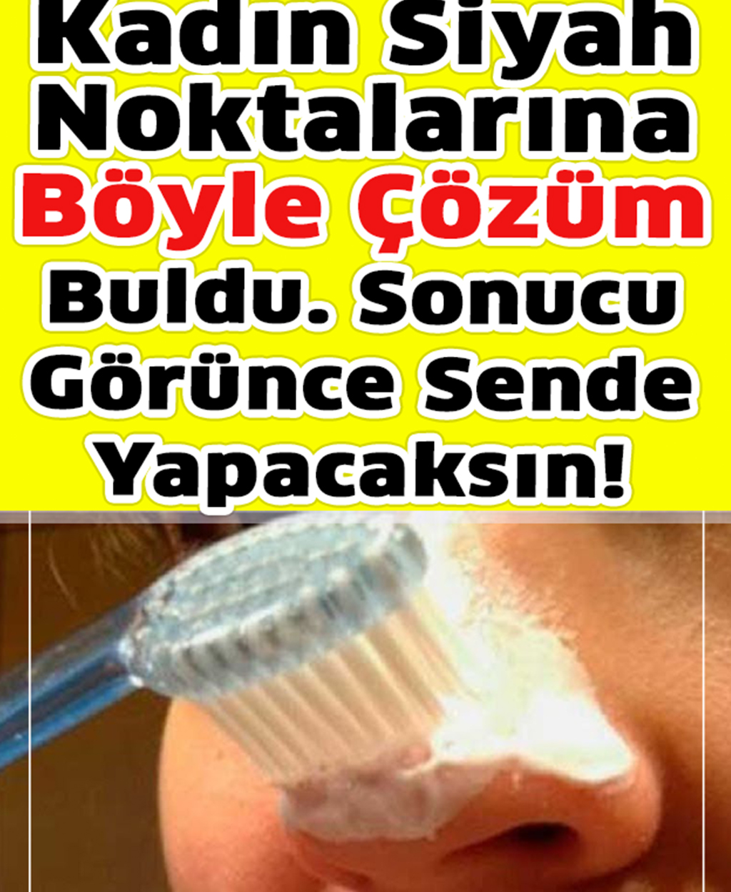 Bir Kadın Siyah Noktalara Tamamen Yeni Bir Çözüm Buldu - 1