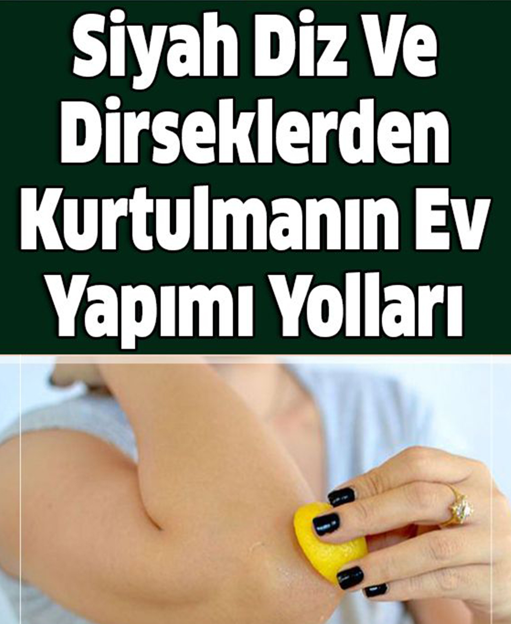Siyah Diz Ve Dirseklerden Kurtulmanın Ev Yapımı Yolları - 1