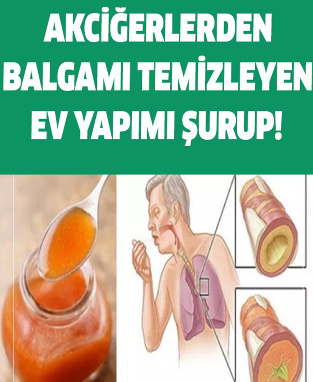 Akciğerlerden Balgam Temizlemede Kullanılan Yöntem - 1
