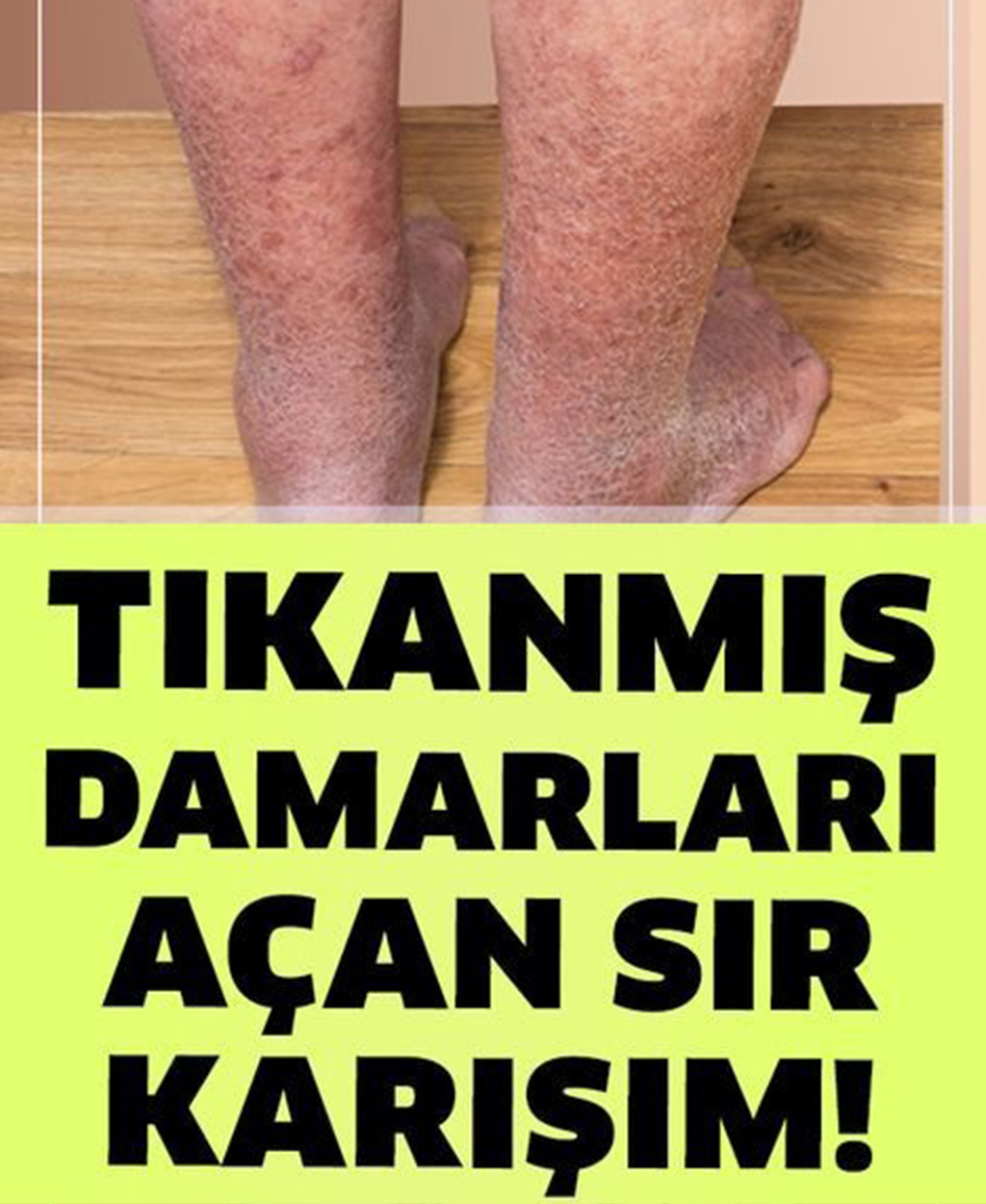 Damarlarınızı Tertemiz Yapacak Sır - 1