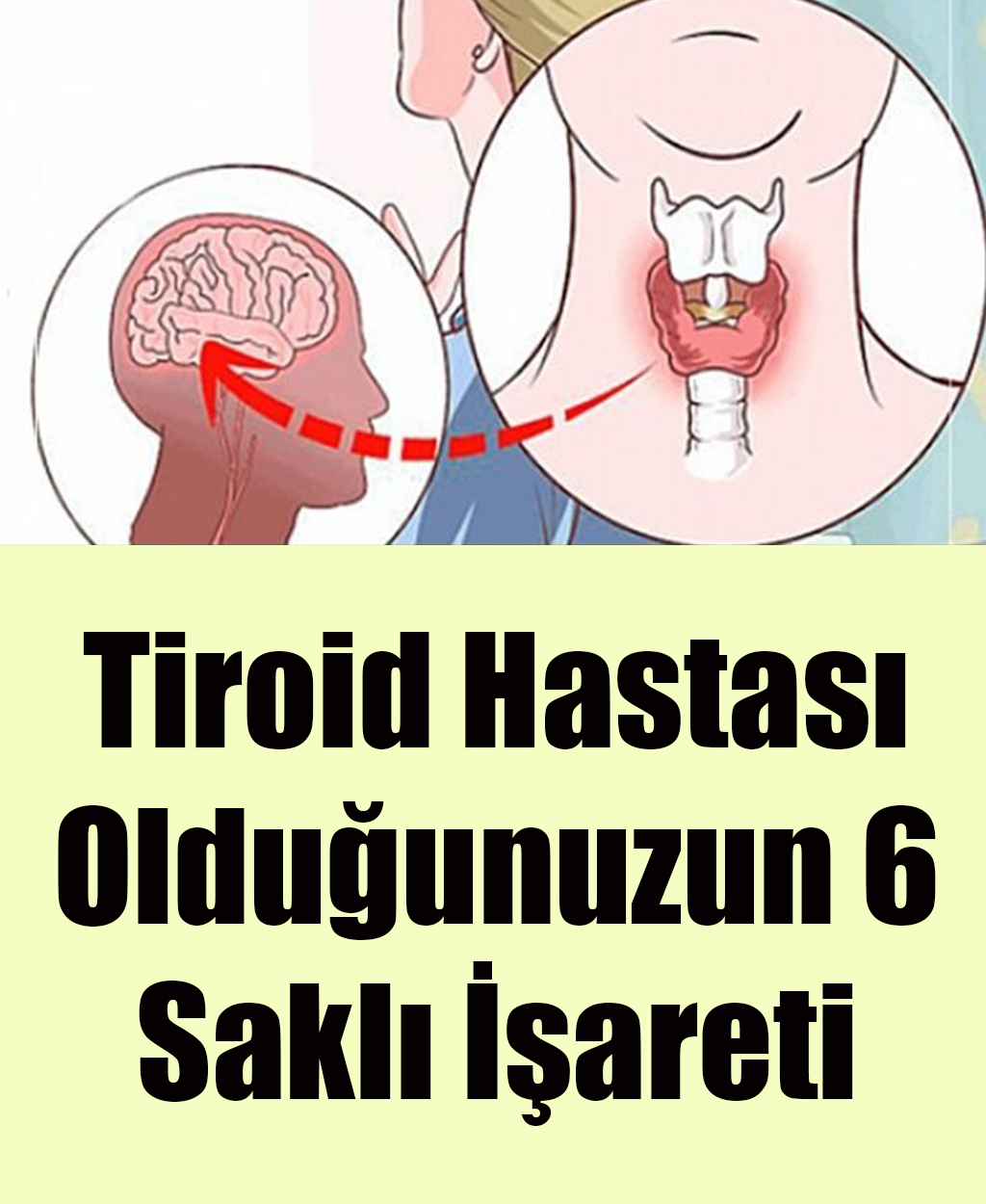 Tiroid Hastası Olduğunuzun 6 Gizli İşareti	 - 1