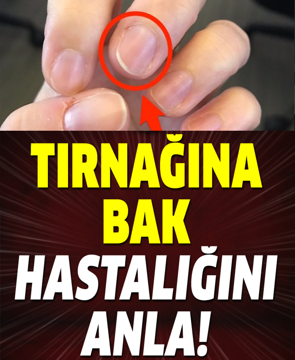 Tırnağına bak hastalığı anla - 1
