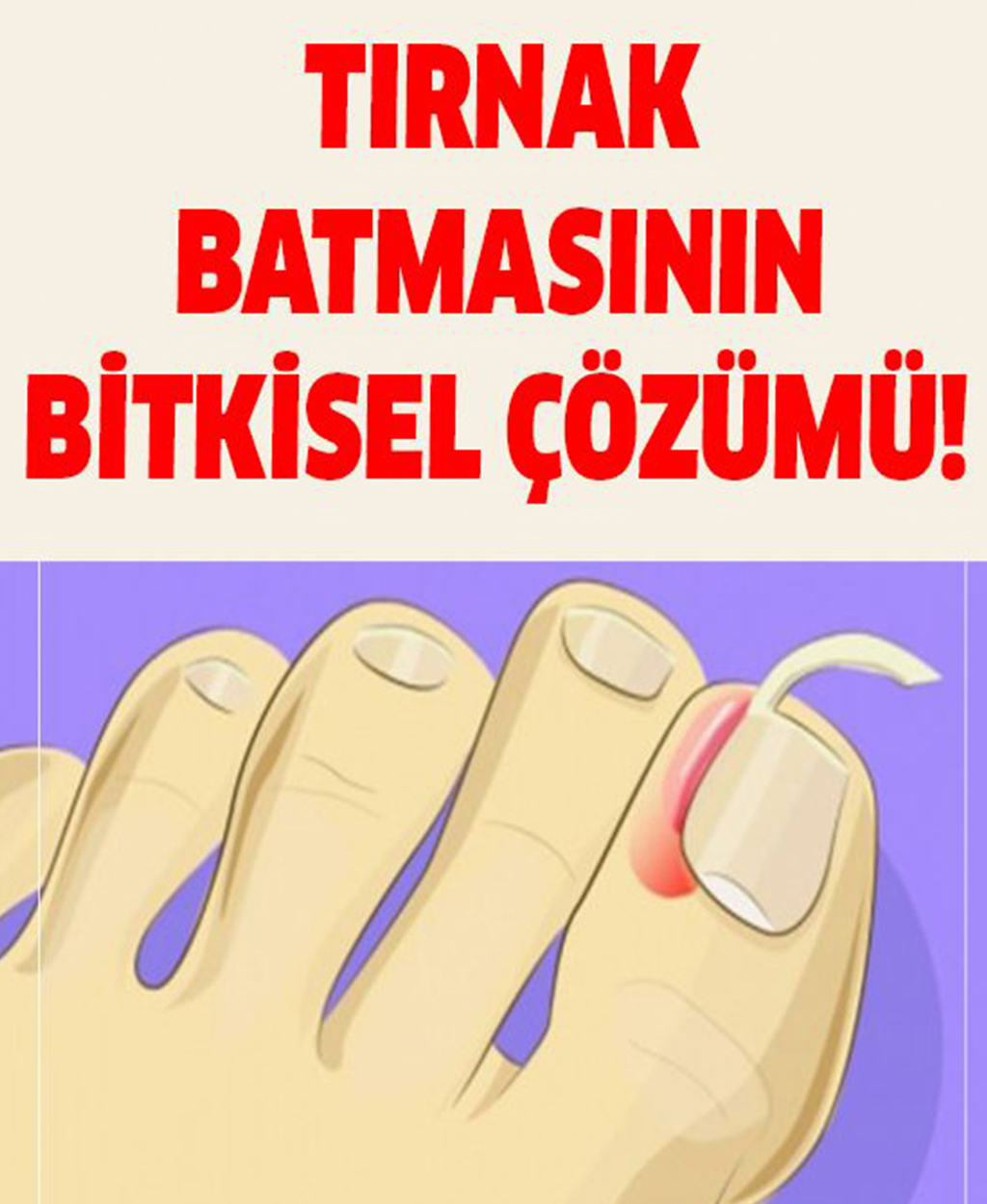 TIRNAK BATMASI BİTKİSEL ÇÖZÜMLER - 1