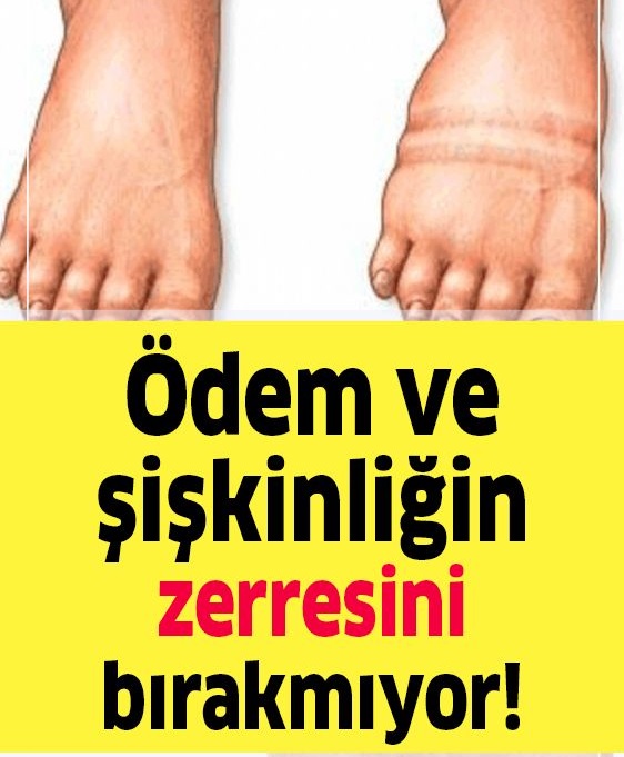 İnsanda Ödem ve Şişkinliğin Zerresini Bırakmayan Yiyecek - 1