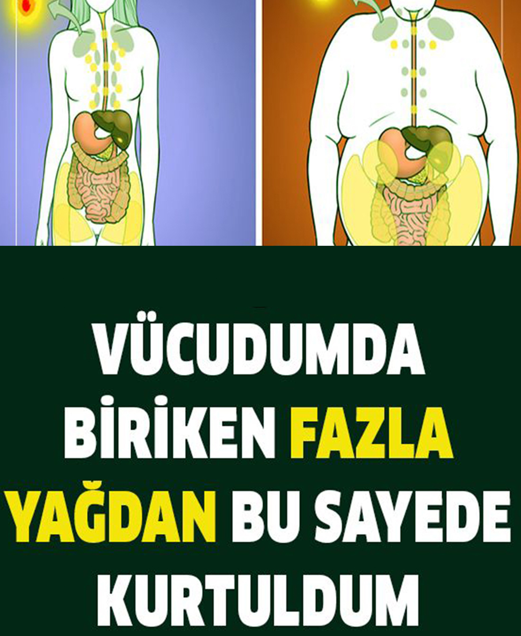 Vücudunuzda aşırı yağ birikimi nerede olur? Nasıl kurtulursunuz? - 1
