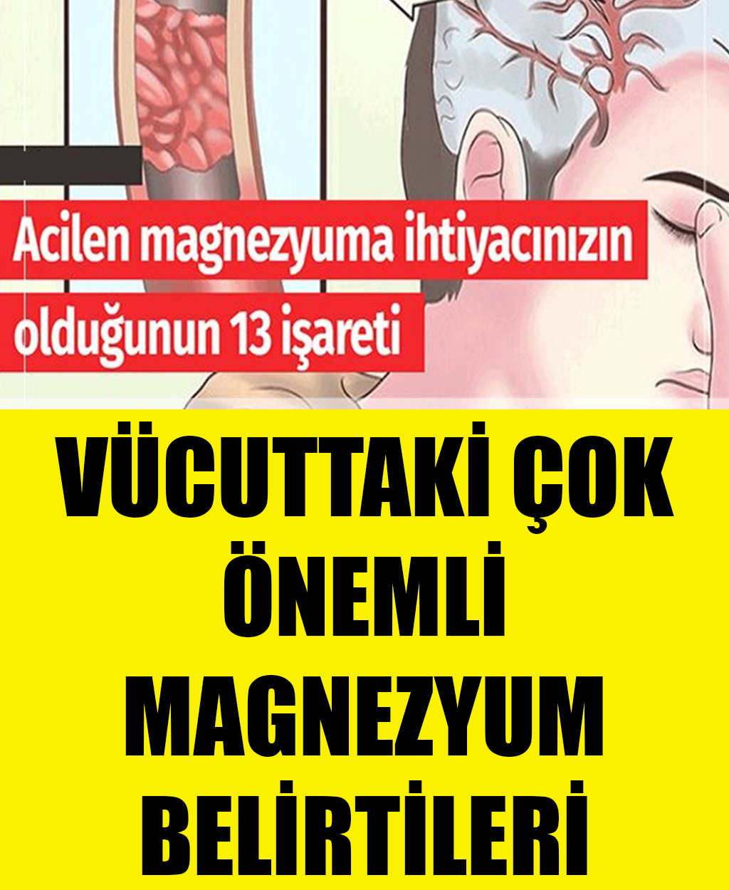Acilen Magnezyuma Lüzumunuzun Olduğunun 13 İşareti	 - 1